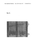 SPINOCEREBELLAR ATAXIA TYPE 8 AND METHODS OF DETECTION diagram and image