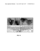 ALKYLATED SEMI-SYNTHETIC GLYCOSAMINOGLYCAN ETHERS, AND METHODS OF MAKING AND USING THEREOF diagram and image