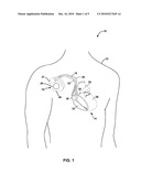 DISSOLVABLE PHARMACEUTICAL IMPLANT diagram and image