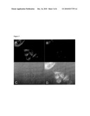 HISTONE DEACETYLASE INHIBITORS diagram and image