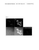 HISTONE DEACETYLASE INHIBITORS diagram and image