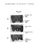 NOVEL BIOLOGICAL SUBSTANCE NESFATIN AND ITS RELATED SUBSTANCES AND USES THEREOF diagram and image