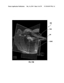 MRI-Guided Devices and MRI-Guided Interventional Systems that can Track and Generate Dynamic Visualizations of the Devices in near Real Time diagram and image