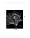 MRI-Guided Devices and MRI-Guided Interventional Systems that can Track and Generate Dynamic Visualizations of the Devices in near Real Time diagram and image