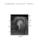 MRI-Guided Devices and MRI-Guided Interventional Systems that can Track and Generate Dynamic Visualizations of the Devices in near Real Time diagram and image