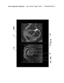 MRI-Guided Devices and MRI-Guided Interventional Systems that can Track and Generate Dynamic Visualizations of the Devices in near Real Time diagram and image