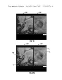 MRI-Guided Devices and MRI-Guided Interventional Systems that can Track and Generate Dynamic Visualizations of the Devices in near Real Time diagram and image