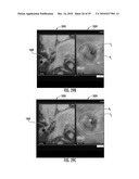 MRI-Guided Devices and MRI-Guided Interventional Systems that can Track and Generate Dynamic Visualizations of the Devices in near Real Time diagram and image