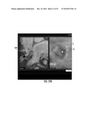 MRI-Guided Devices and MRI-Guided Interventional Systems that can Track and Generate Dynamic Visualizations of the Devices in near Real Time diagram and image
