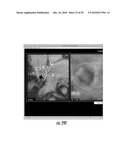 MRI-Guided Devices and MRI-Guided Interventional Systems that can Track and Generate Dynamic Visualizations of the Devices in near Real Time diagram and image