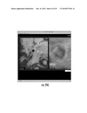 MRI-Guided Devices and MRI-Guided Interventional Systems that can Track and Generate Dynamic Visualizations of the Devices in near Real Time diagram and image