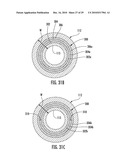 MRI-Guided Devices and MRI-Guided Interventional Systems that can Track and Generate Dynamic Visualizations of the Devices in near Real Time diagram and image