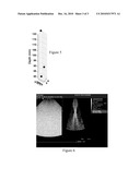 FEEDBACK IN MEDICAL ULTRASOUND IMAGING FOR HIGH INTENSITY FOCUSED ULTRASOUND diagram and image