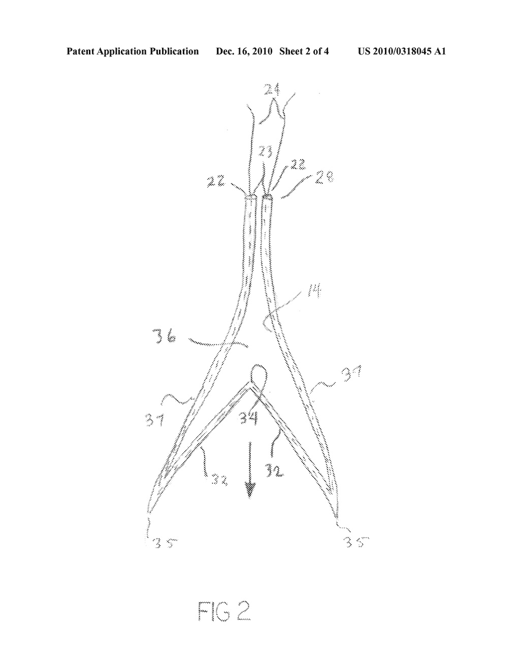 TISSUE SPECIMEN RETRIEVAL BAG, METHOD FOR RETRIEVING TISSUE - diagram, schematic, and image 03