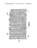 WOUND PACKING MATERIAL FOR USE WITH SUCTION diagram and image