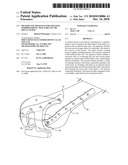 METHOD AND APPARATUS FOR TREATING PERIPROSTHETIC FRACTURES OF THE DISTAL FEMUR diagram and image