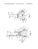 METHOD AND APPARATUS FOR TREATING PERIPROSTHETIC FRACTURES OF THE DISTAL FEMUR diagram and image