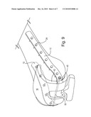 METHOD AND APPARATUS FOR TREATING PERIPROSTHETIC FRACTURES OF THE DISTAL FEMUR diagram and image