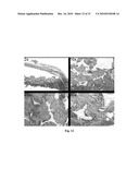 COMPOSITE MESH DEVICES AND METHODS FOR SOFT TISSUE REPAIR diagram and image