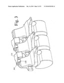 DEVICES AND METHODS FOR INTER-VERTEBRAL ORTHOPEDIC DEVICE PLACEMENT diagram and image