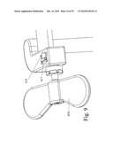 DEVICES AND METHODS FOR INTER-VERTEBRAL ORTHOPEDIC DEVICE PLACEMENT diagram and image