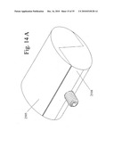 DEVICES AND METHODS FOR INTER-VERTEBRAL ORTHOPEDIC DEVICE PLACEMENT diagram and image