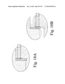 DEVICES AND METHODS FOR INTER-VERTEBRAL ORTHOPEDIC DEVICE PLACEMENT diagram and image