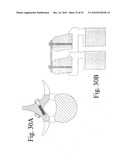 DEVICES AND METHODS FOR INTER-VERTEBRAL ORTHOPEDIC DEVICE PLACEMENT diagram and image