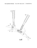 Cutters for Accessing a Fiber within a Fiber Optic Cable to Splice Thereto and Tools and Methods Using the Same diagram and image