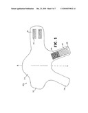 PRESSURE-APPLYING GARMENT FOR ANIMALS diagram and image