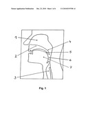 DEVICE FOR SPLINTING A CAVITY, ORGAN DUCT AND/OR VESSEL diagram and image