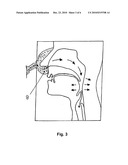 DEVICE FOR SPLINTING A CAVITY, ORGAN DUCT AND/OR VESSEL diagram and image