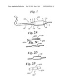 Balloon Cones and Waists Thinning Methodology diagram and image