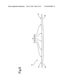 REINFORCING BRACE diagram and image