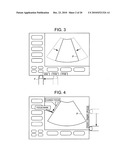 ULTRASONOGRAPH diagram and image