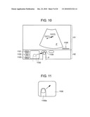 ULTRASONOGRAPH diagram and image