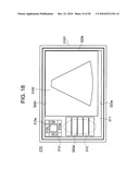 ULTRASONOGRAPH diagram and image