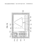 ULTRASONOGRAPH diagram and image