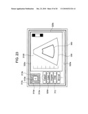 ULTRASONOGRAPH diagram and image