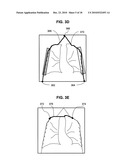 SYSTEMS, METHODS, APPARATUSES, AND COMPUTER PROGRAM PRODUCTS FOR COMPUTER AIDED LUNG NODULE DETECTION IN CHEST TOMOSYNTHESIS IMAGES diagram and image