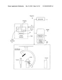 System for Detecting Catheterization Devices diagram and image