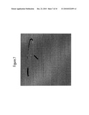 System for Detecting Catheterization Devices diagram and image