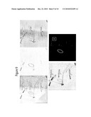 System for Detecting Catheterization Devices diagram and image