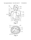 ORAL DRUG COMPLIANCE MONITORING USING MAGNETIC-FIELD SENSORS diagram and image