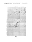 Detection of hepatitis C virus RNA diagram and image