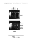 STROMAL INTERACTING MOLECULE KNOCKOUT MOUSE AND USES THEREOF diagram and image