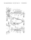 LACROSSE HEAD WITH SIDEWALLS OF ASYMMETRICAL HEIGHT diagram and image