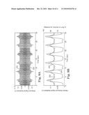 PHYSIOLOGIC SIGNAL MONITORING USING ULTRASOUND SIGNALS FROM IMPLANTED DEVICES diagram and image