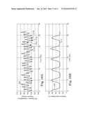 PHYSIOLOGIC SIGNAL MONITORING USING ULTRASOUND SIGNALS FROM IMPLANTED DEVICES diagram and image