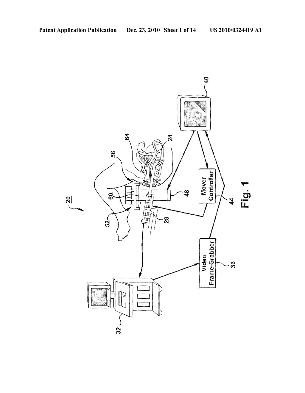 ULTRASOUND IMAGING SYSTEM AND METHODS OF IMAGING USING THE SAME - diagram, schematic, and image 02